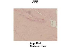 Sample Type : Mouse hippo campus  Primary Antibody Dilution :  1:100  Secondary Antibody: Anti-rabbit-HRP  Secondary Antibody Dilution:  1:300  Color/Signal Descriptions: App: Red Nucleus: Blue  Gene Name: APP  Submitted by: Teresa Gunn (APP 抗体  (Middle Region))