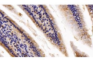 Detection of CAT in Mouse Small intestine Tissue using Polyclonal Antibody to Catalase (CAT)