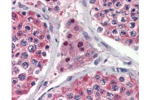 IDH1 antibody was used for immunohistochemistry at a concentration of 4-8 ug/ml. (IDH1 抗体)