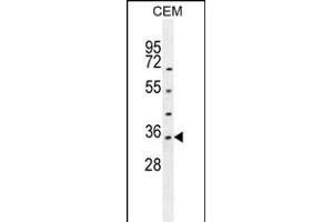 LDHAL6A Antibody (Center) (ABIN654842 and ABIN2844509) western blot analysis in CEM cell line lysates (35 μg/lane). (LDHAL6A 抗体  (AA 154-183))