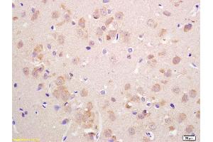 Formalin-fixed and paraffin embedded rat brain labeled with Anti-VGLUT2 Polyclonal Antibody, Unconjugated  at 1:200 followed by conjugation to the secondary antibody and DAB staining. (Solute Carrier Family 17 (Vesicular Glutamate Transporter), Member 6 (SLC17A6) (AA 1-50) 抗体)