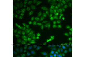 Immunofluorescence analysis of MCF-7 cells using RPL5 Polyclonal Antibody (RPL5 抗体)