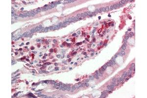 Immunohistochemistry (IHC) image for anti-Cytochrome P450, Family 2, Subfamily C, Polypeptide 18 (CYP2C18) (N-Term) antibody (ABIN6755288)