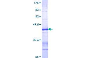 ZBTB33 Protein (AA 564-673) (GST tag)