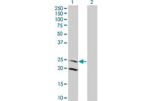 Western Blot analysis of IL6 expression in transfected 293T cell line by IL6 monoclonal antibody (M09), clone 3F12. (IL-6 抗体  (AA 29-212))