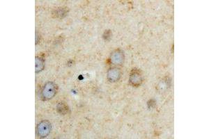 Immunohistochemical analysis of SPHK2 staining in human brain formalin fixed paraffin embedded tissue section. (SPHK2 抗体  (C-Term))