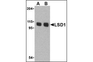 Western blot analysis of LSD1 in P815 cell lysate with this product at (A) 1 and (B) 2 μg/ml. (LSD1 抗体  (N-Term))