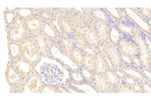 Detection of MMP1 in Human Kidney Tissue using Polyclonal Antibody to Matrix Metalloproteinase 1 (MMP1) (MMP1 抗体  (AA 98-275))