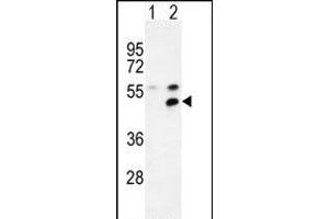 Western blot analysis of P1 (arrow) using rabbit polyclonal P1 Antibody (Center) (ABIN654665 and ABIN2844361). (MPP1 抗体  (AA 301-327))