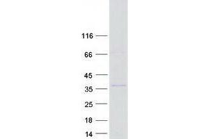 Western Blotting (WB) image for E3 Ubiquitin-Protein Ligase UNKL (UNKL) (Transcript Variant 2) protein (Myc-DYKDDDDK Tag) (ABIN2735023)