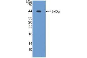 Detection of Recombinant WFDC2, Human using Polyclonal Antibody to WAP Four Disulfide Core Domain Protein 2 (WFDC2) (WFDC2 抗体  (AA 30-124))