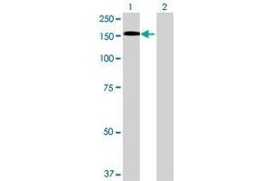 Lane 1: PLK4 transfected lysate ( 106. (PLK4 293T Cell Transient Overexpression Lysate(Denatured))