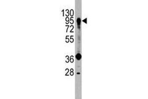 Western blot analysis of PROX1 antibody and HepG2 lysate. (PROX1 抗体  (AA 185-214))