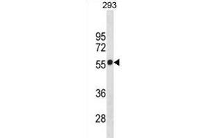 CB1 Antibody (Center) (ABIN1881140 and ABIN2838680) western blot analysis in 293 cell line lysates (35 μg/lane). (CNR1 抗体  (AA 161-187))