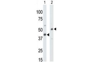 Western Blotting (WB) image for anti-Creatine Kinase, Mitochondrial 1, Ubiquitous (CKMT1) antibody (ABIN5022957) (CKMT1 抗体)