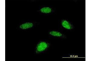 Immunofluorescence of monoclonal antibody to RPS6KB2 on HeLa cell. (RPS6KB2 抗体  (AA 1-100))