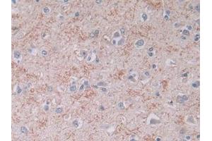 Detection of BNP in Human Cerebrum Tissue using Monoclonal Antibody to Brain Natriuretic Peptide (BNP) (BNP 抗体)