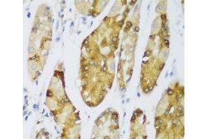 Immunohistochemistry of paraffin-embedded Human stomach using ERLIN1 Polyclonal Antibody at dilution of 1:100 (40x lens). (ERLIN1 抗体)