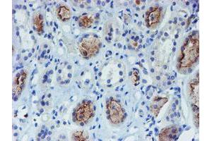 Immunohistochemistry (IHC) image for anti-Docking Protein 7 (DOK7) antibody (ABIN1497885) (DOK7 抗体)