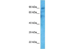 WB Suggested Anti-TRPV2 antibody Titration: 1 ug/mL Sample Type: Human HT1080 Whole Cell