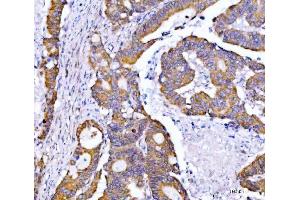 IHC analysis of Syntaxin 18/STX18 using anti-Syntaxin 18/STX18 antibody (ABIN7599259).