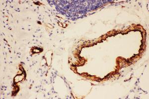 Immunohistochemistry (IHC) image for anti-Adiponectin (ADIPOQ) (AA 19-244) antibody (ABIN3042521)