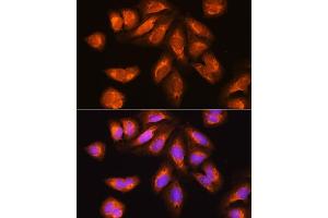 Immunofluorescence analysis of U2OS cells using EXOSC2 Rabbit pAb (ABIN6127886, ABIN6140374, ABIN6140375 and ABIN6214708) at dilution of 1:100. (EXOSC2 抗体  (AA 1-293))