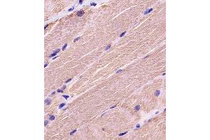A staining MYBPC3 in human skeletal muscle tissue sections by Immunohistochemistry (IHC-P - paraformaldehyde-fixed, paraffin-embedded sections). (MYBPC3 抗体  (N-Term))