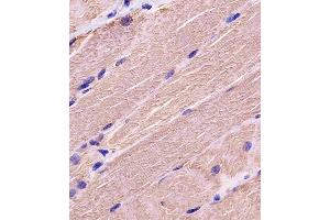 A staining MYBPC3 in human skeletal muscle tissue sections by Immunohistochemistry (IHC-P - paraformaldehyde-fixed, paraffin-embedded sections). (MYBPC3 抗体  (N-Term))