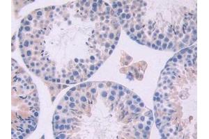 Detection of OSM in Mouse Testis Tissue using Polyclonal Antibody to Oncostatin M (OSM) (Oncostatin M 抗体  (AA 116-205))
