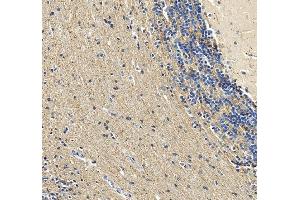 IHC analysis of Calretinin/CALB2 using anti-Calretinin/CALB2 antibody (ABIN7602106).