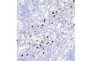 Immunohistochemistry (Paraffin-embedded Sections) (IHC (p)) image for anti-CD177 Molecule (CD177) antibody (ABIN7073372)