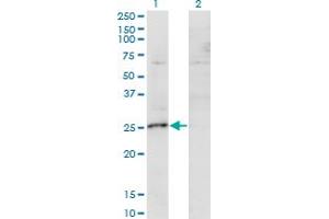 Western Blot analysis of MIS12 expression in transfected 293T cell line by MIS12 monoclonal antibody (M01), clone 1G3. (MIS12 抗体  (AA 1-205))