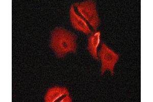Tubulin alpha staining Human fetal heart cells by ICC/IF. (alpha Tubulin 抗体)