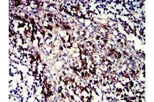 Immunohistochemical analysis of paraffin-embedded tonsil tissues using CD319 mouse mAb with DAB staining. (SLAMF7 抗体  (AA 23-226))