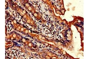 Immunohistochemistry (IHC) image for anti-ELOVL Fatty Acid Elongase 4 (ELOVL4) (AA 270-314) antibody (ABIN7151564)
