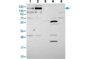 Western blot analysis of Lane 1: RT-4, Lane 2: U-251 MG, Lane 3: Human Plasma, Lane 4: Liver, Lane 5: Tonsil with TMEM2 polyclonal antibody  at 1:250-1:500 dilution. (TMEM2 抗体)