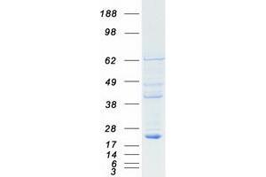 Western Blotting (WB) image for Retinoblastoma Binding Protein 9 (RBBP9) protein (Myc-DYKDDDDK Tag) (ABIN2730600)