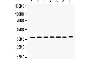 Western Blotting (WB) image for anti-Histone Deacetylase 11 (HDAC11) (AA 47-81), (N-Term) antibody (ABIN3043840) (HDAC11 抗体  (N-Term))
