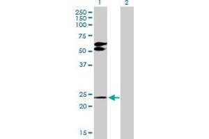 Western Blot analysis of TGIF2 expression in transfected 293T cell line by TGIF2 MaxPab polyclonal antibody. (TGIF2 抗体  (AA 1-237))
