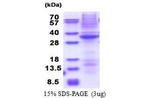 STK17A Protein (AA 64-321) (His tag)