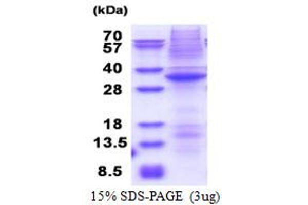 STK17A Protein (AA 64-321) (His tag)
