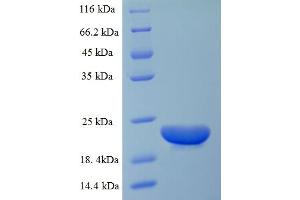 SDS-PAGE (SDS) image for Chemokine (C-C Motif) Ligand 20 (CCL20) (AA 27-96) protein (His-SUMO Tag) (ABIN5711595)