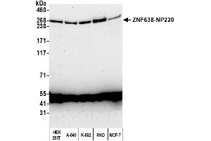 Western Blotting (WB) image for anti-Zinc Finger Protein 638 (ZNF638) (AA 1928-1978) antibody (ABIN7450948) (ZNF638 抗体  (AA 1928-1978))