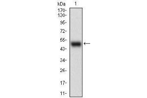 Western blot analysis using APBB1IP mAb against human APBB1IP (AA: 1-151) recombinant protein. (Amyloid beta (A4) Precursor Protein-Binding, Family B, Member 1 Interacting Protein (APBB1IP) (AA 1-151) 抗体)