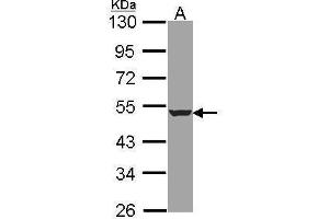 WB Image Sample (30 ug of whole cell lysate) A: A431 , 10% SDS PAGE HADHB antibody antibody diluted at 1:1000 (HADHB 抗体  (N-Term))