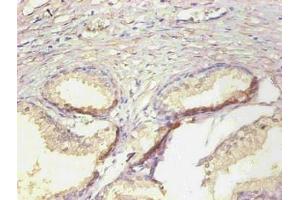 Immunohistochemical of paraffin-embedded human prostate tissue using ABIN7161512 at dilution of 1:200 (Lipocalin 2 抗体)