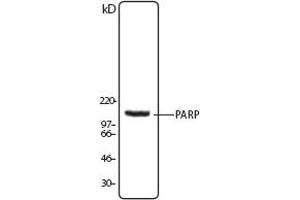 Image no. 1 for anti-Poly (ADP-Ribose) Polymerase 1 (PARP1) (N-Term) antibody (ABIN307559) (PARP1 抗体  (N-Term))