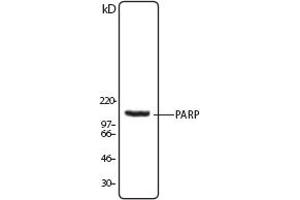 Image no. 1 for anti-Poly (ADP-Ribose) Polymerase 1 (PARP1) (N-Term) antibody (ABIN307559) (PARP1 抗体  (N-Term))