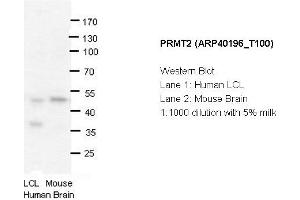 Image no. 1 for anti-Protein Arginine Methyltransferase 2 (PRMT2) (N-Term) antibody (ABIN183891) (PRMT2 抗体  (N-Term))